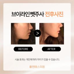 プランエスクリニック PlanSクリニック｜江南駅・三成(COEX)(ソウル)の美容医療