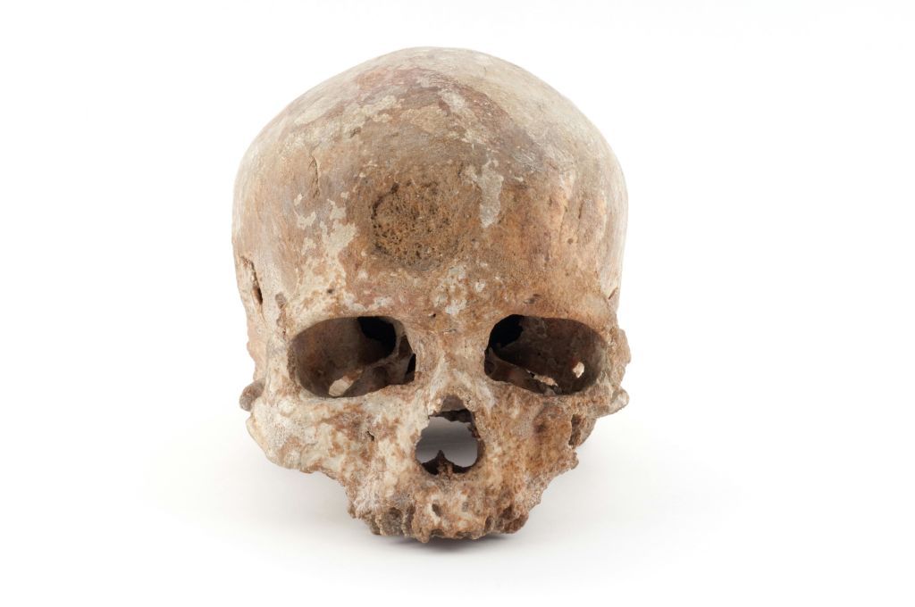 눈에 띄는 마모와 누락된 톱니가 있는 풍화된 인간 두개골로, 평범한 흰색 배경에 세팅되어 있습니다.