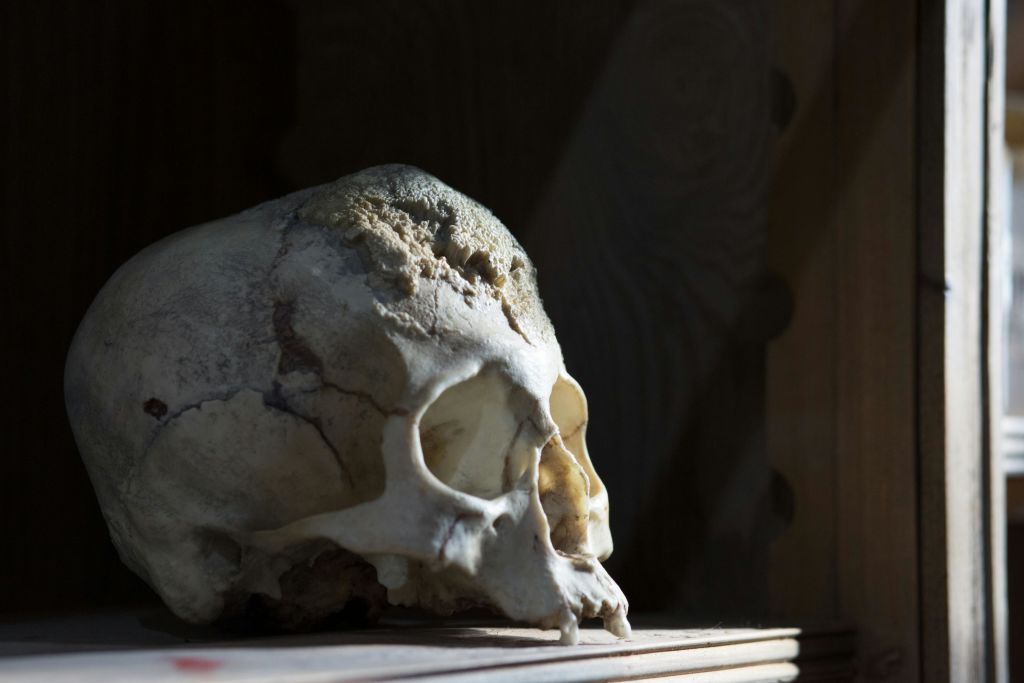 인간의 두개골은 조명이 희미한 공간의 표면에 놓여 균열과 질감을 강조합니다.